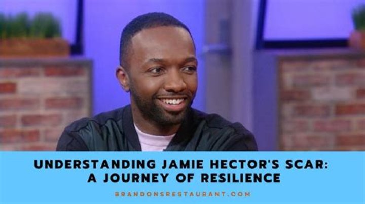 Jamie Hector's Scar: The Story Behind the Actor's Unique Mark