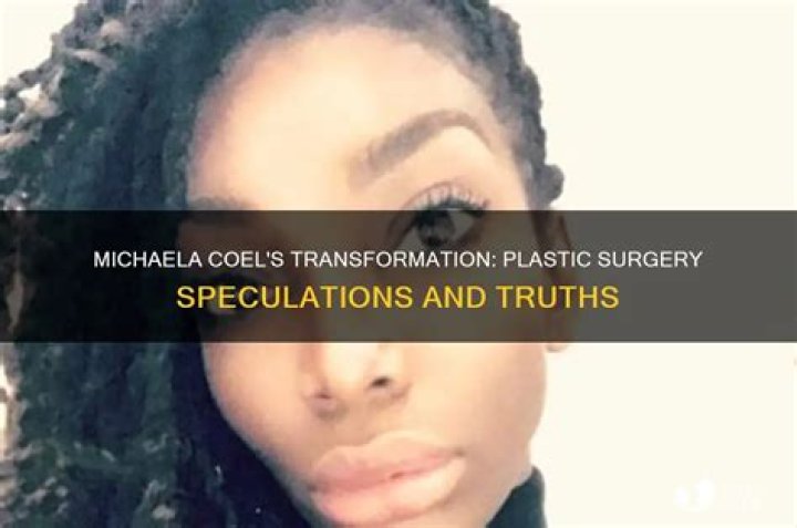 Michaela Coel Plastic Surgery: Exploring the Truth Behind the Transformations
