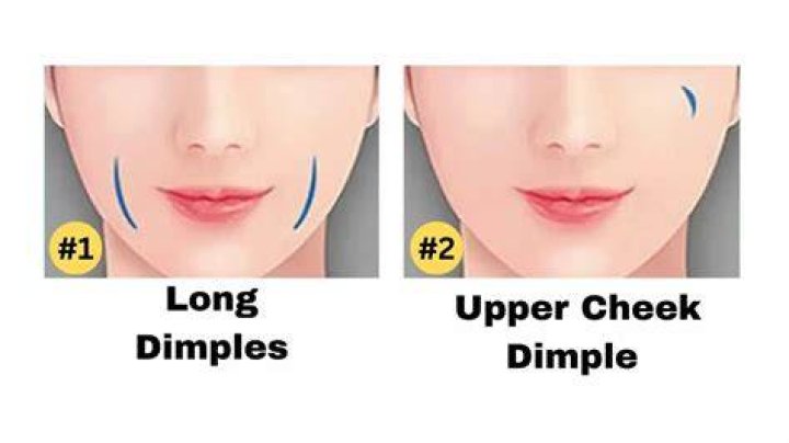 Unlock the Enigmatic Charms of Facial Dimples: Discover the Varieties